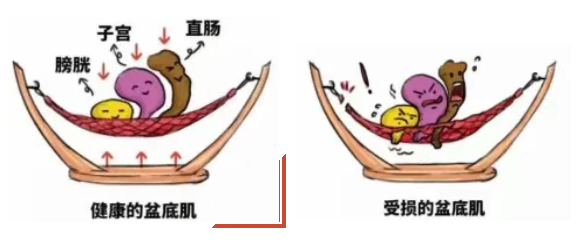 a2a6df32-057f-49de-a617-ebca4530912f