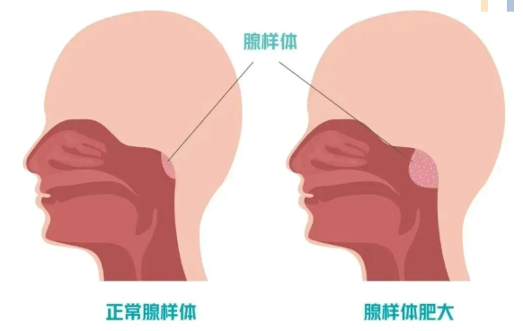 acd22185-8920-4743-baf3-31f92bcd7a84