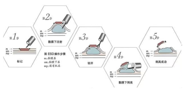 cb220586-9459-402c-b3ff-d5848bd7ed6f