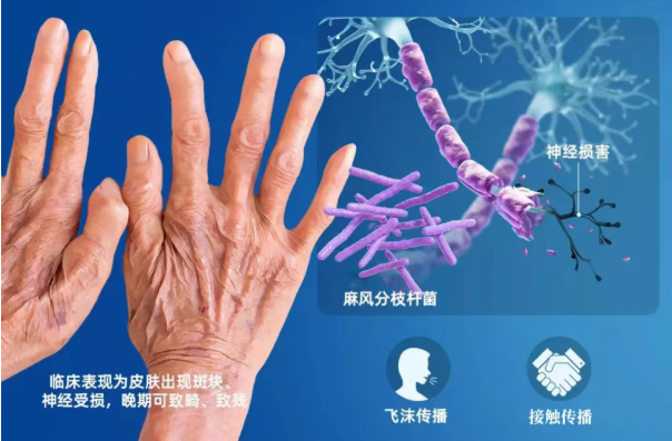 e915fce2-bb9d-445a-82f8-50c3f058aded