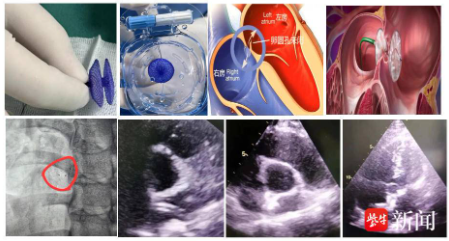 f1bc9e5e-c7d8-4182-bdef-05fff5cfa313 f1bc9e5e-c7d8-4182-bdef-05fff5cfa313