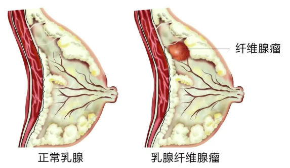 4efc409c-b61a-49e9-948b-f79e7b8f664e